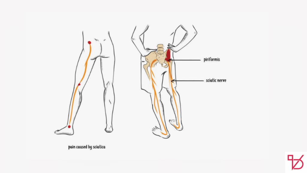 Say Goodbye to Sciatic Nerve Pain in Just 10 Minutes with This Natural Method