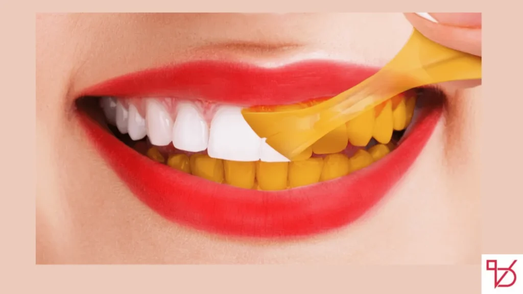 Why Are My Teeth Yellow When I Brush Them Every Day?