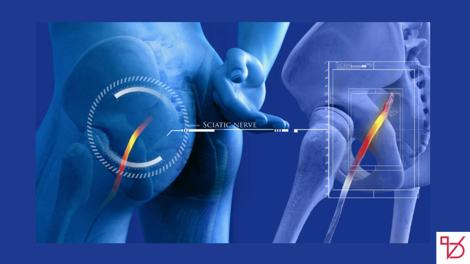 Say Goodbye to Sciatic Nerve Pain in Just 10 Minutes with This Natural Method